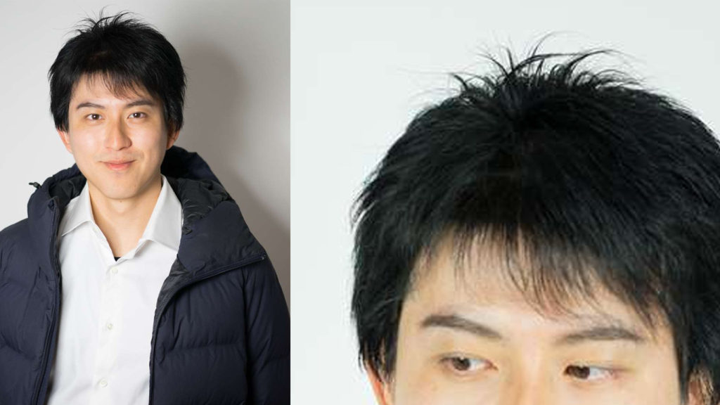 医療用ウィッグ男性黒髪