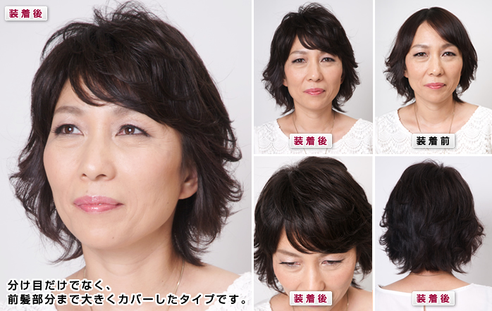 ヘアピースFシリーズの装着写真